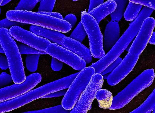 E. coli en sık kadınlarda sistit gelişimini tetikler